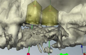 3Dシミュレーションにて設計