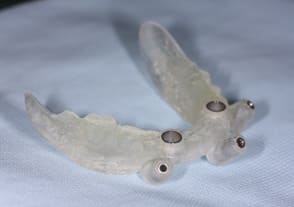 サージカルガイド